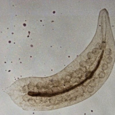 Egel und Würmer im Gartenteich Gartenteich Ratgeber