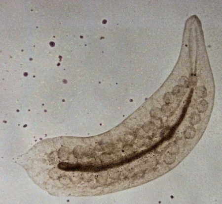 Der Glas-Strudelwurm