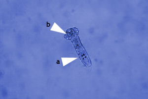 Kiemenwürmer unter dem Mikroskop