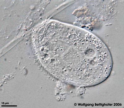 Chilodonella-uncinata - Parasiten beim Koi